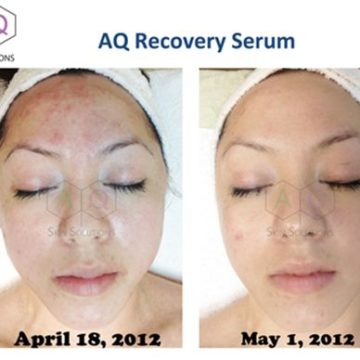 AQ Recovery Serum
